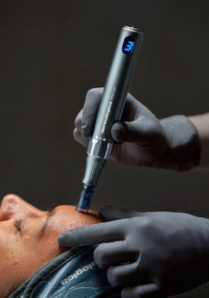 Dermalogica PRO Microneedling in Reading